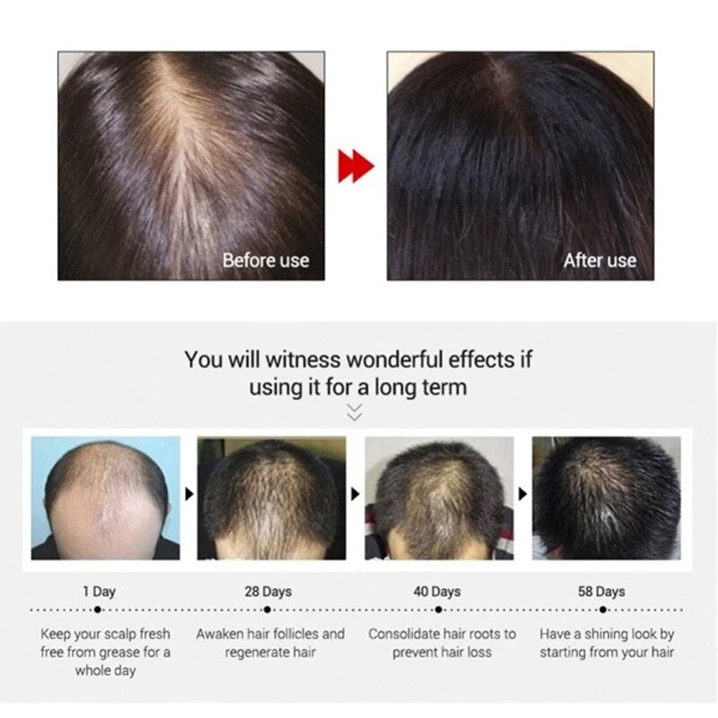 Repair Oil Hair Growth Treatments